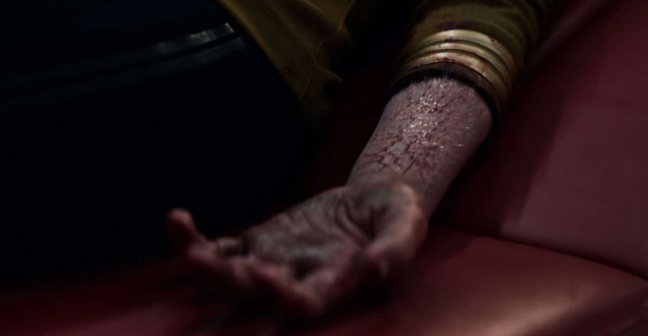 Still frame from Star Trek: Strange New Worlds Season 2 Episode 10 (2023) showing Captain Batel's infected forearm.
