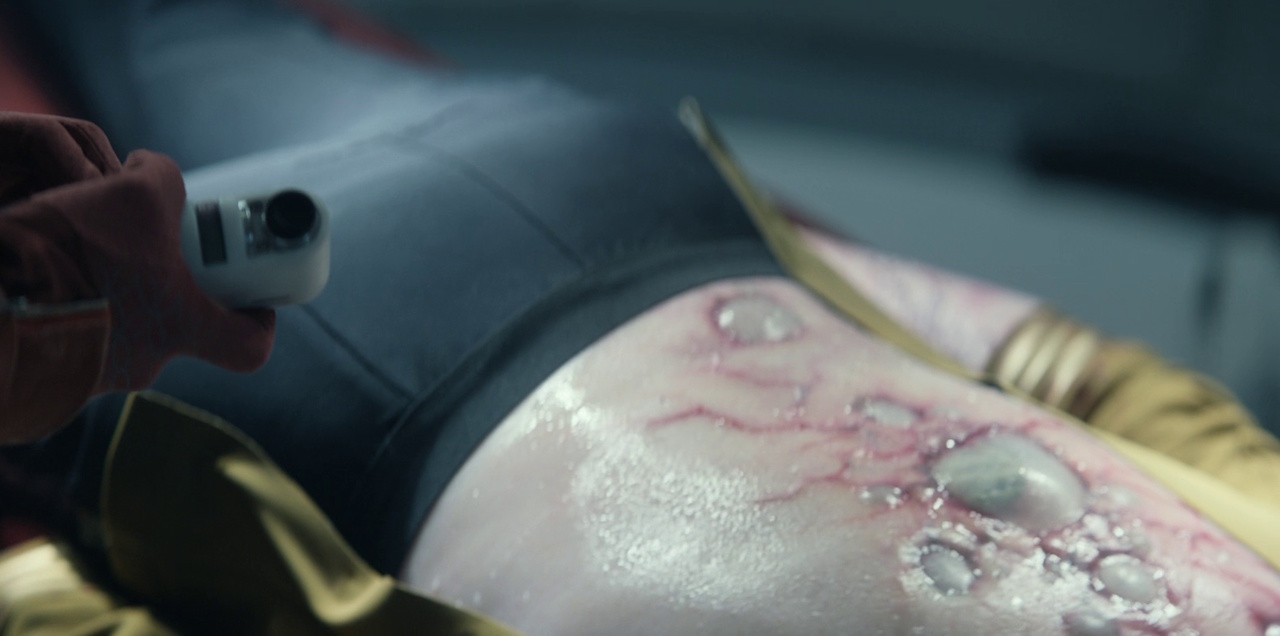 Still frame from Star Trek: Strange New Worlds 3x01: Hegemony, Part II, showing Captain Batel's Gorn-infected back.