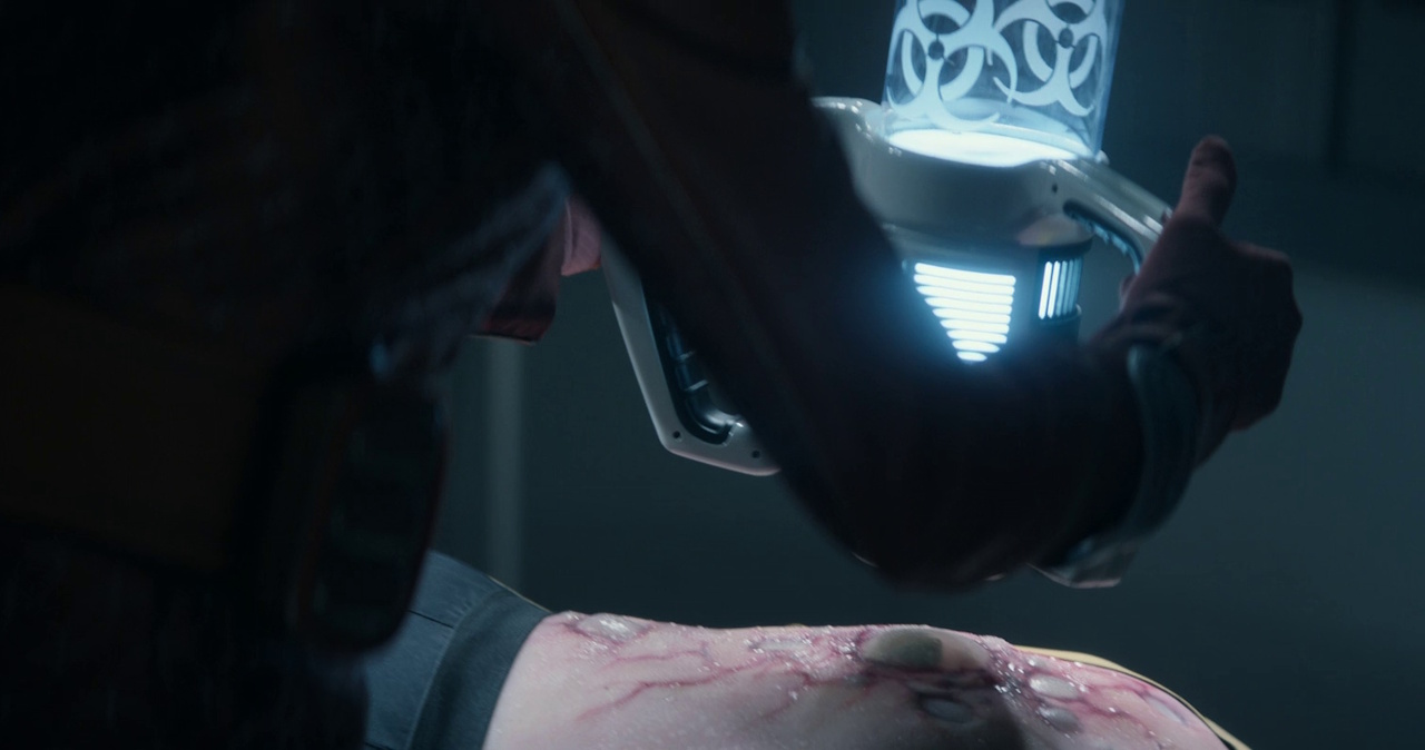 Still frame from Star Trek: Strange New Worlds 3x01: Hegemony, Part II, showing the surgery on Captain Batel.