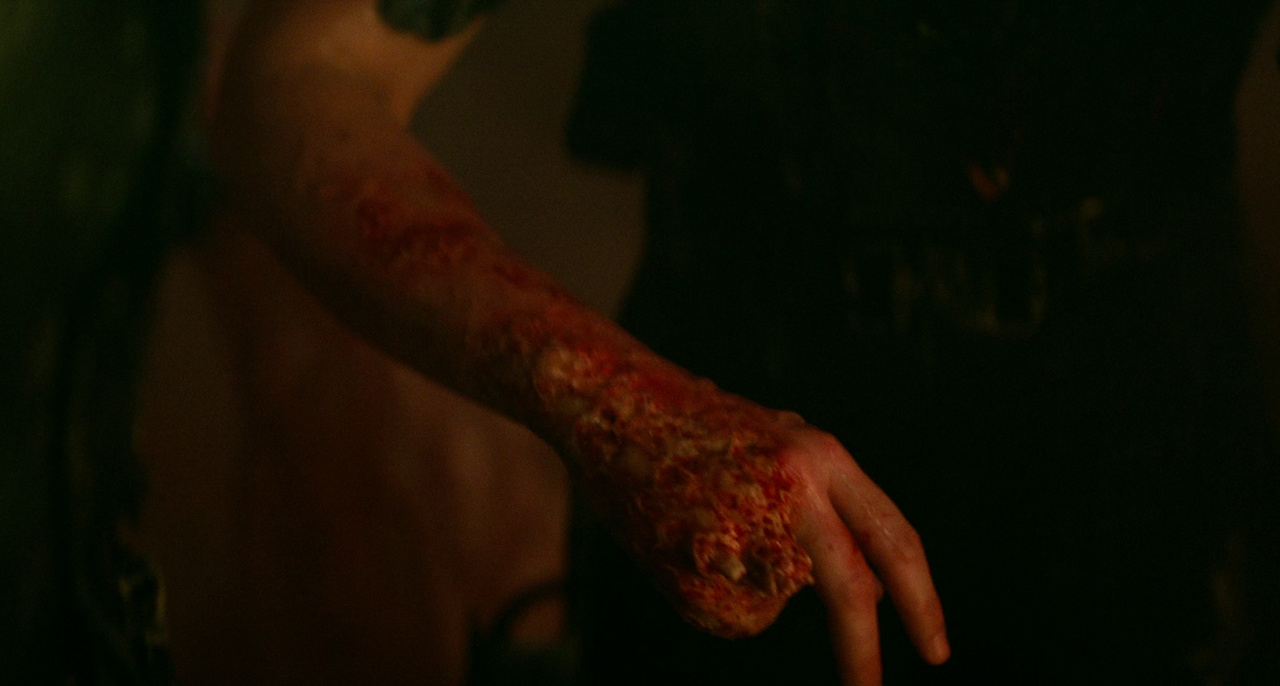 Still frame from Star Trek: Strange New Worlds 3x01: Hegemony, Part II, showing Ortegas' injured hand (with two missing fingers).